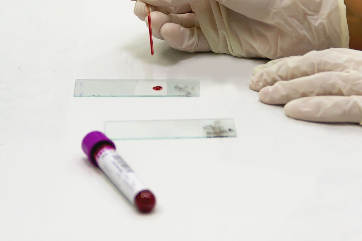 Profissional manipulando amostras em laboratório